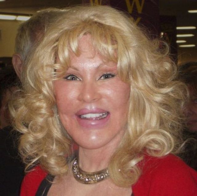 Jocelyn Wildensteins Plastic Surgery The Facts The Myths The Truth - w6c1uy8