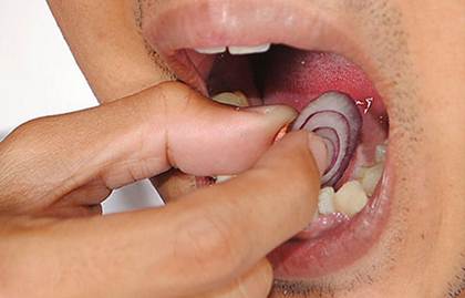 obat sakit gigi tradisional