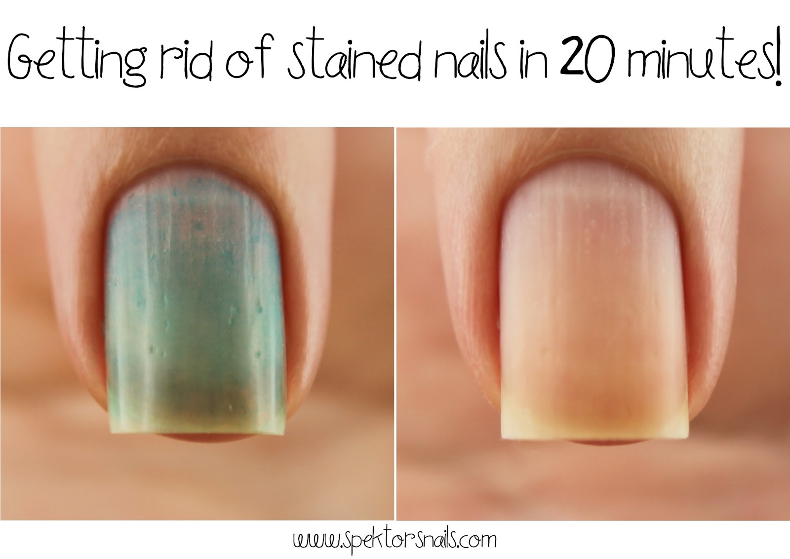 Spektor's Nails How To Remove Nail Polish Stains