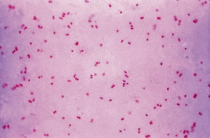 Gram Negative Cocci In Clusters