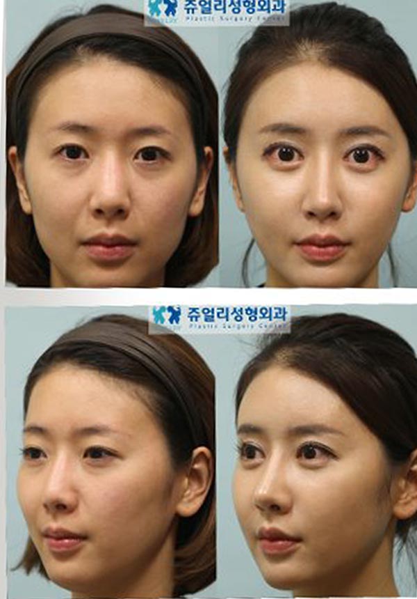 Life's a Picture: Korean Female Faces set on default