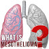 Mesothelioma: Survival Rate, Factors & Improvement
