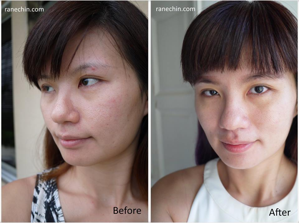 The Beauty Junkie - ranechin.com: [Review] Oshan Infinite Collagen