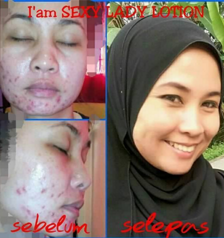 testimoni i am sexy lady whitening & burn fat lotion