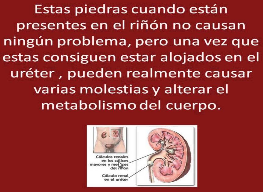 Educar desde la familia: Formas de acabar con las piedras del riñón