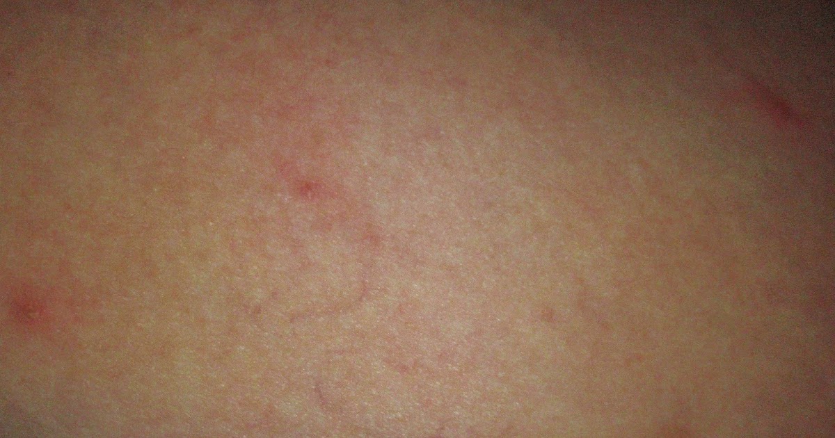 The Juicy Beauty Word Itchy Bumps from Shaving