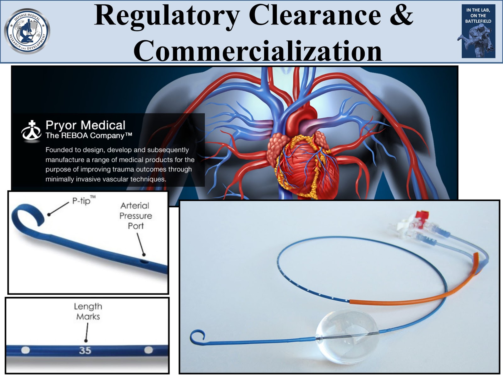 Resuscitative Endovascular Balloon Occlusion of the Aorta (REBOA)? by