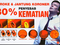 Obat Alami Yang Ampuh Dan Manjur Untuk Mengobati Jantung Obat Alami Yang Ampuh Dan Manjur Untuk Mengobati Jantung