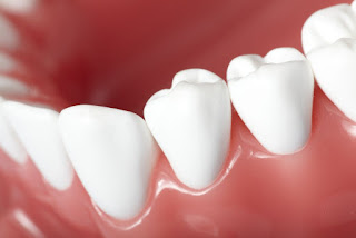 Nettoyage en profondeur des dents Comment nettoyer en profondeur vos dents