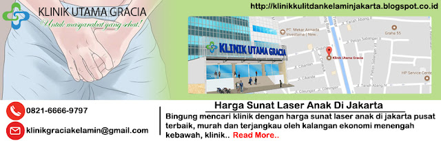 harga sunat laser anak di jakarta harga sunat laser anak di jakarta