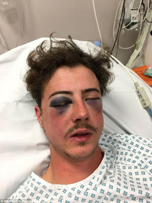 0 See the way this Tottenham fan was beaten by his own club's fans who thought he was a Chelsea fan