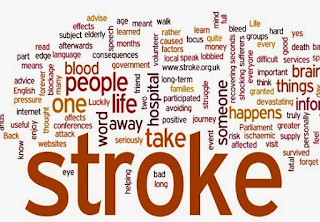 Gejala stroke ringan yang biasa di ketahui Gejala stroke ringan yang biasa di ketahui