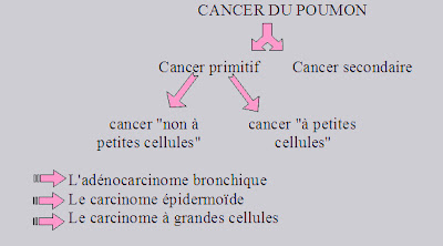 cancer du poumon quels sont les signes