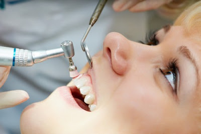 Có nên tẩy trắng răng cho răng sâu không?