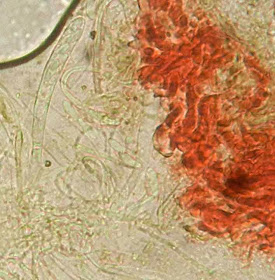 ellipsoid to clavate spores of Patinellaria