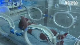 Abandoned Baby Found In China Bin