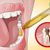 Here's How I Relieved My Toothache Myself and Amazed My Dentist When I Told Him!