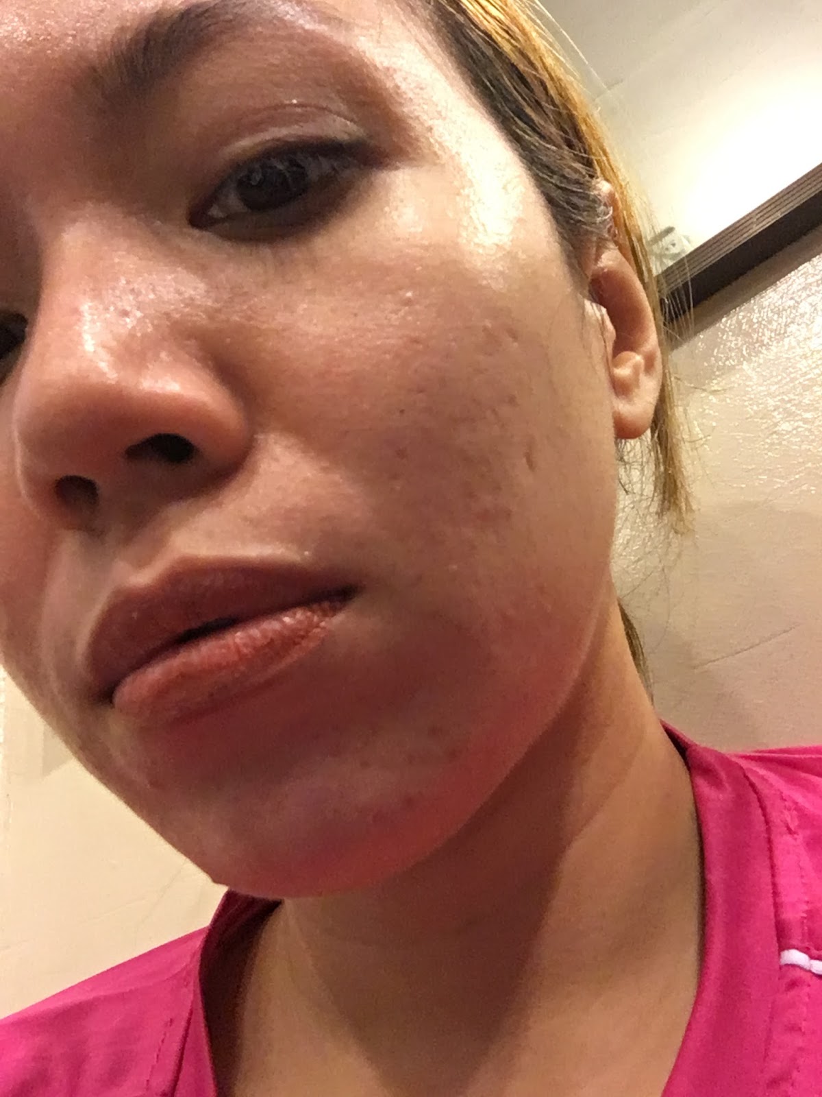 revlite skin 101 price