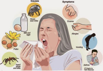 ¿Cómo se contrae una alergia?
