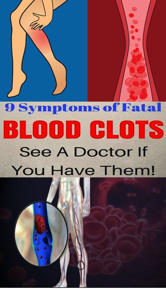 9 Symptoms Of Fatal Blood Clots See A Doctor If You Have Them!!! Stylelos