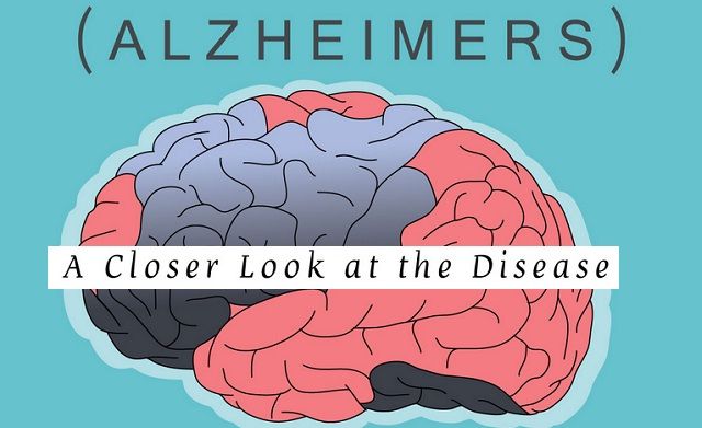 Image: Alzheimers A Closer Look at the Disease #infographic