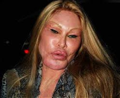 Gossip Depot: Cat lady Jocelyn Wildenstein’s tale of disastrous plastic
