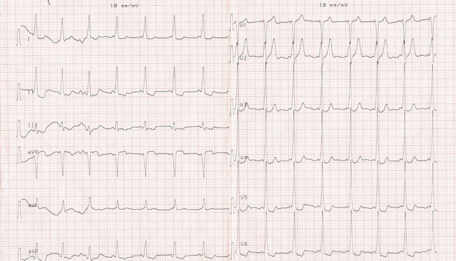 Cardiology window 2019