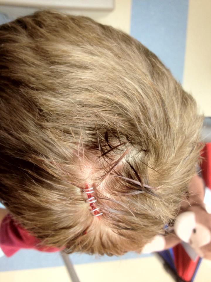 InfertilityMom has Moved to 6 Staples in the Head