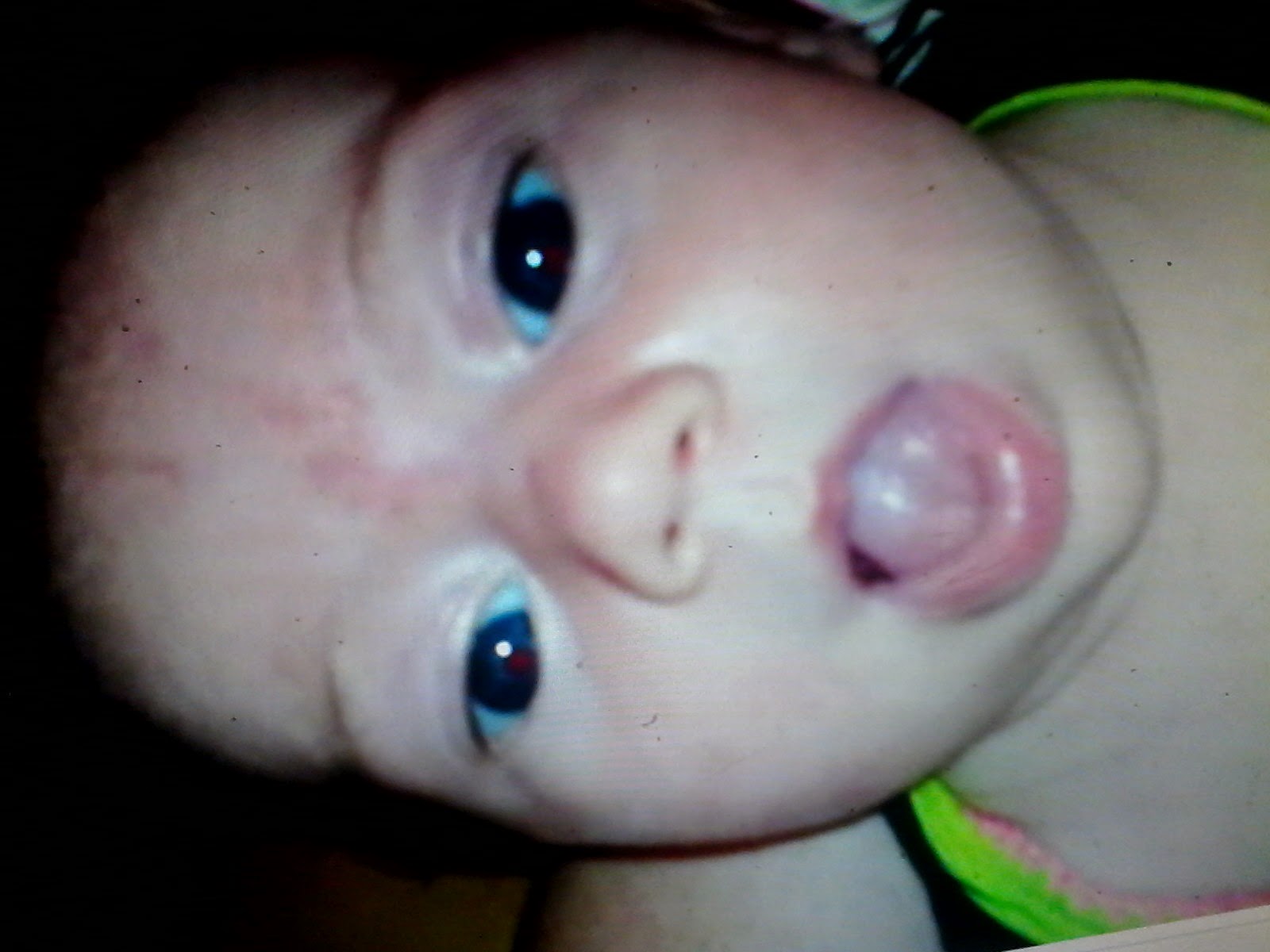 J Voudrais Juste Dire Un Truc Ca Ressemble A Quoi Un Bb Rgo