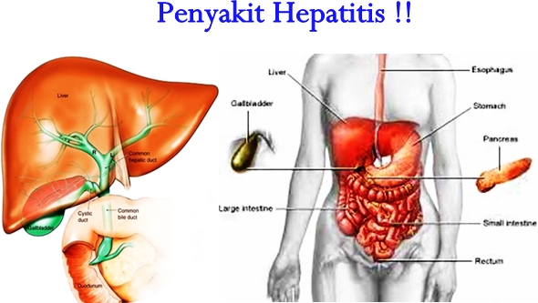 Jenis-jenis Hepatitis