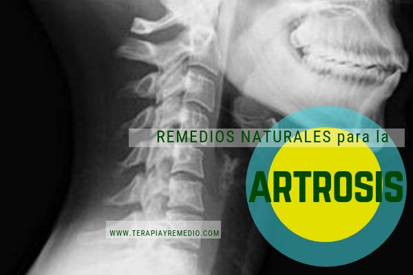 Remedios naturales para la artrosis y las articulaciones