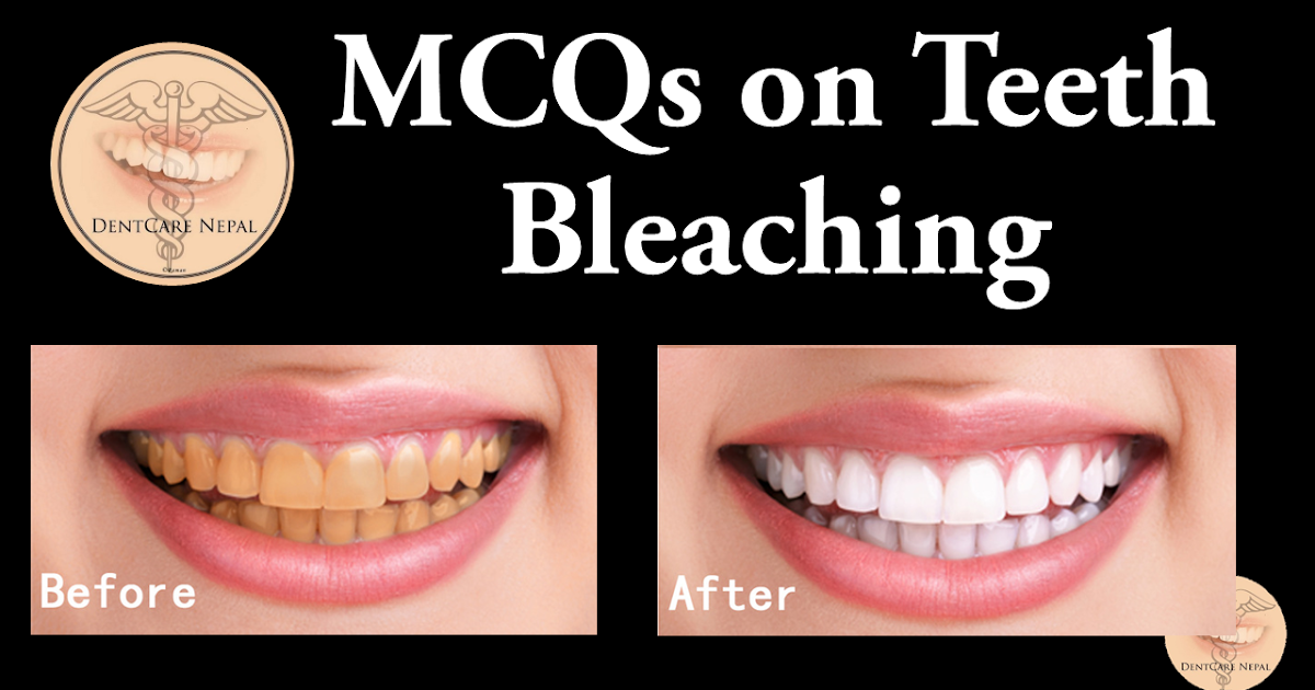 Dentosphere World of Dentistry MCQs on Bleaching of Teeth