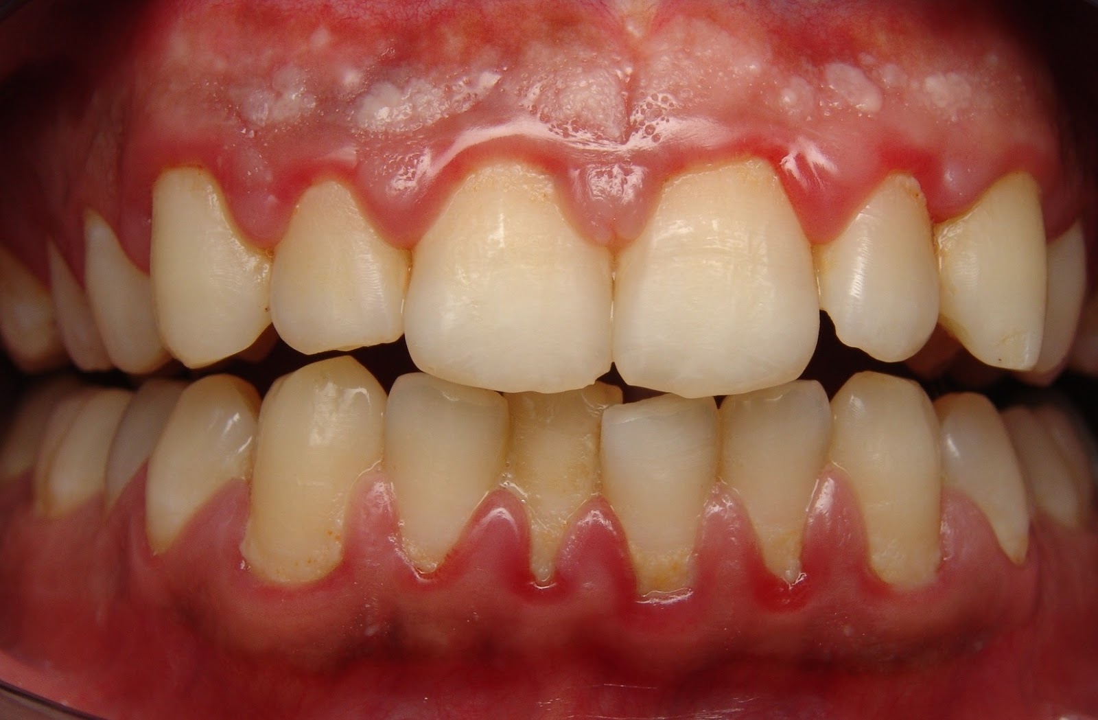 Dr. Duello's Dental Health Blogs
