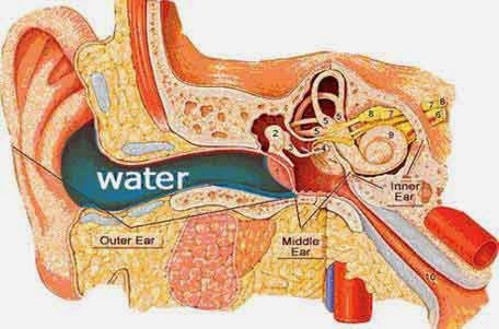 Removing water from the ear