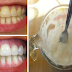 How To Permanently Remove Tartar With Just One Ingredient