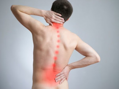 Thoát vị đĩa đệm gây đau đớn nhiều Thoát vị đĩa đệm gây đau đớn nhiều