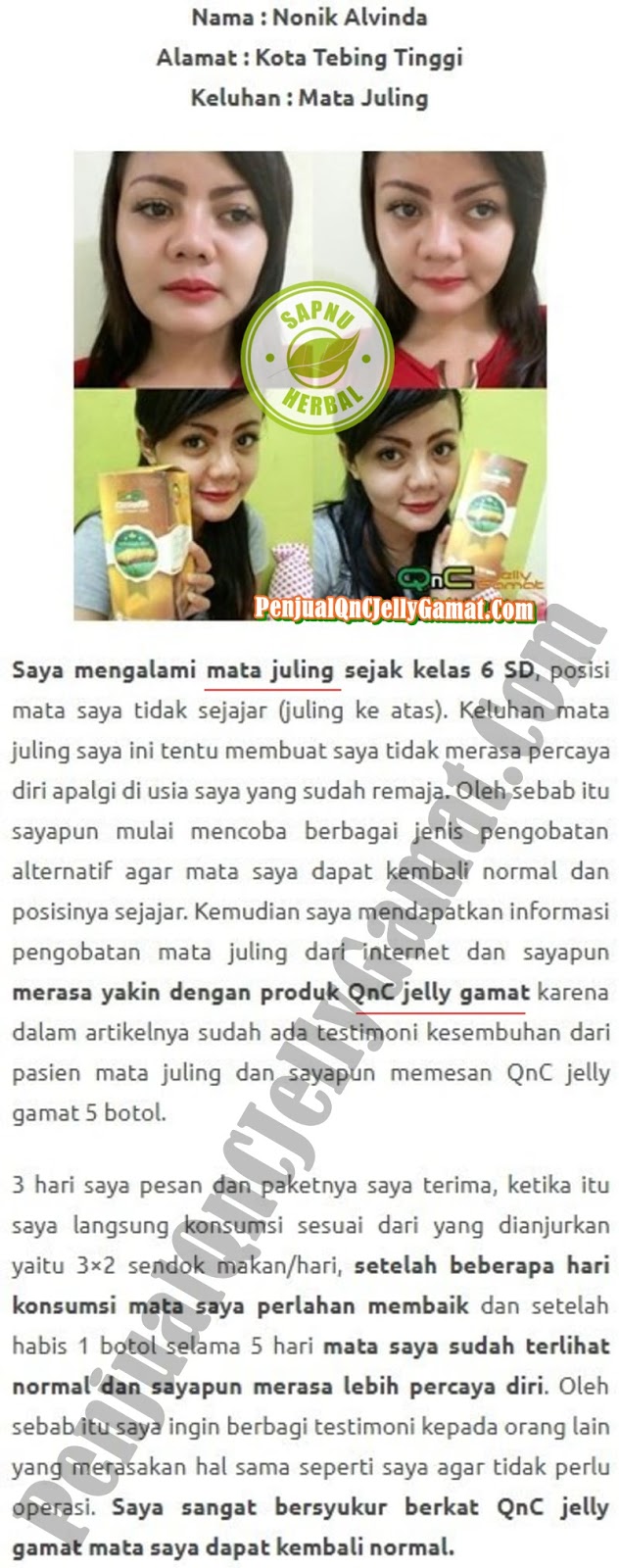 Cara Mengobati Kelopak Mata Bengkak Dan Gatal Secara Alami Terbukti Manjur ~ TESTIMONI QNC JELLY GAMAT Cara Mengobati Kelopak Mata Bengkak Dan Gatal Secara Alami Terbukti Manjur ~ TESTIMONI QNC JELLY GAMAT