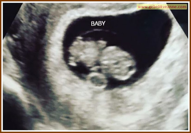 9 haftalık bebeğin görüntüsü