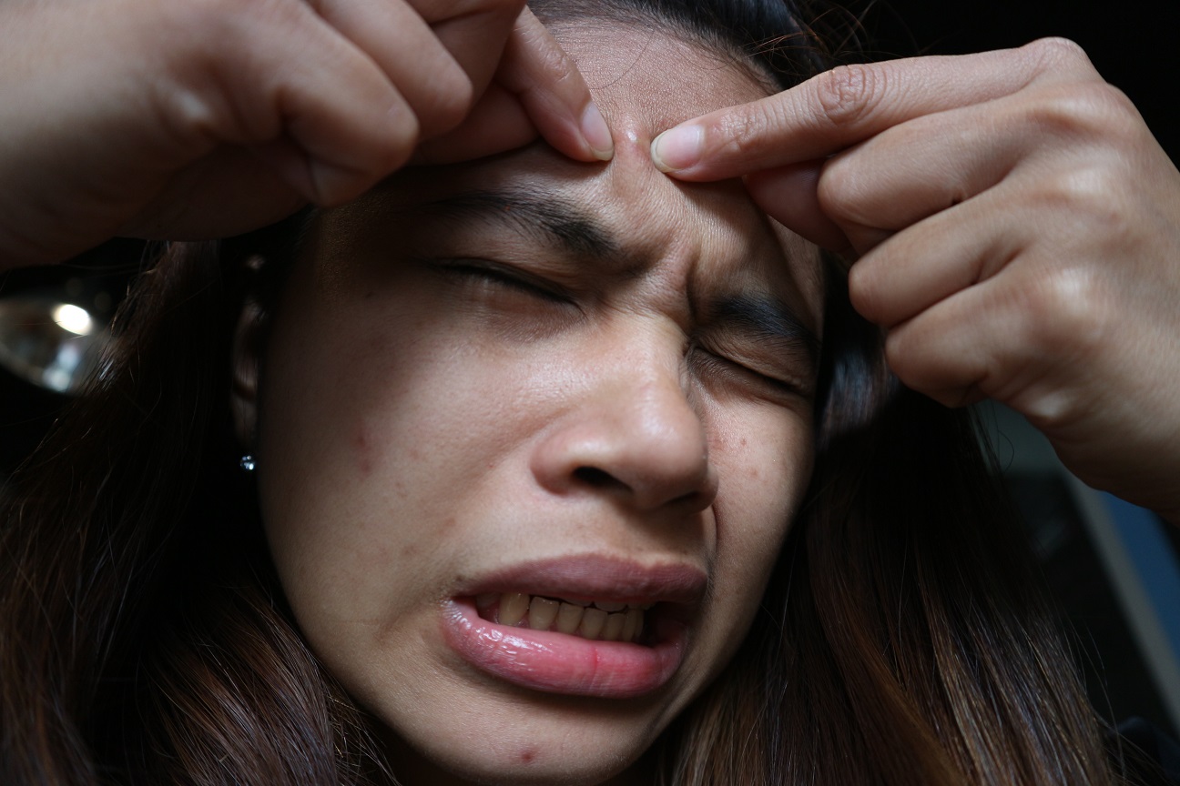 Cara Merawat Wajah Berjerawat - Princess Rhie