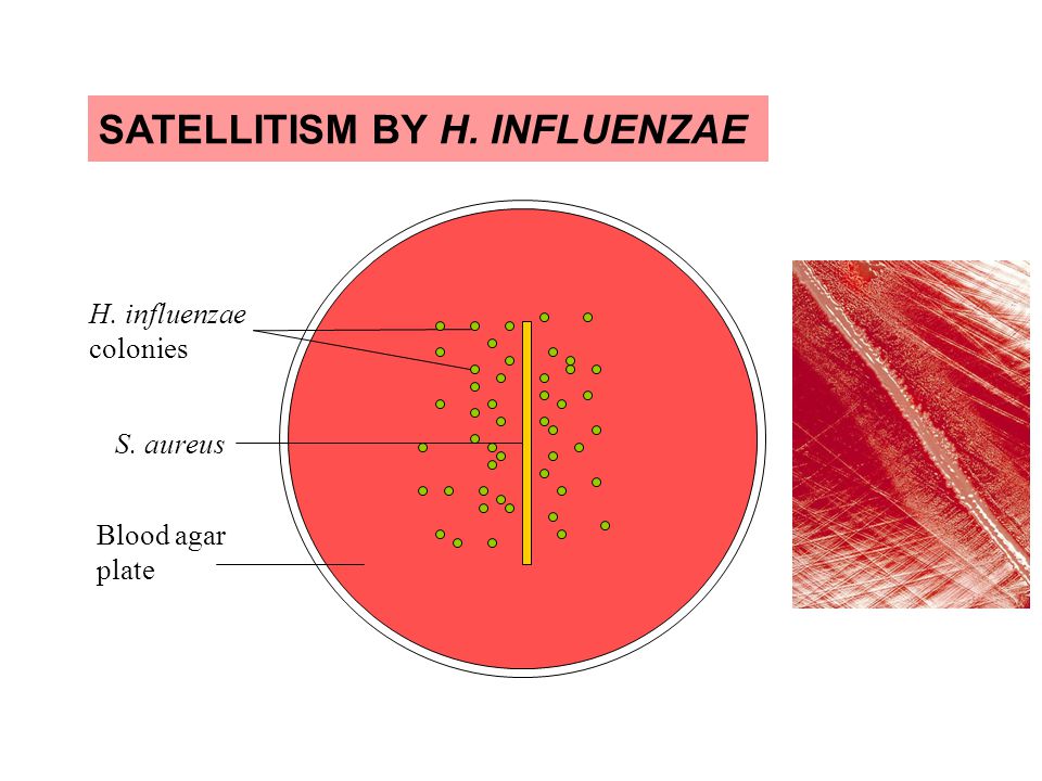 Haemophilus influenzae Characteristics, Habitat , Pathogenicity