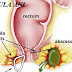 Obat Ambeien Ampuh thumbnail