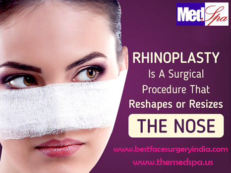 Rhinoplasty surgery–What happens during the surgery?