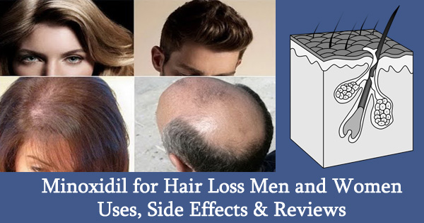 Propecia hair loss side effects