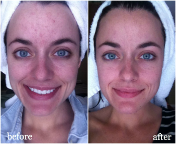 wellbutrin without a rx wellbutrin without a rx