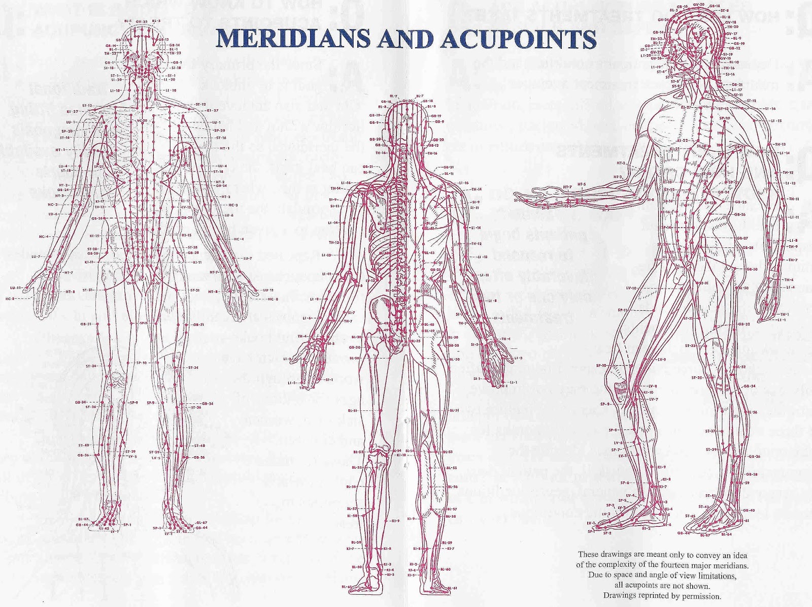 Acupuncture vs. Dry Needling
