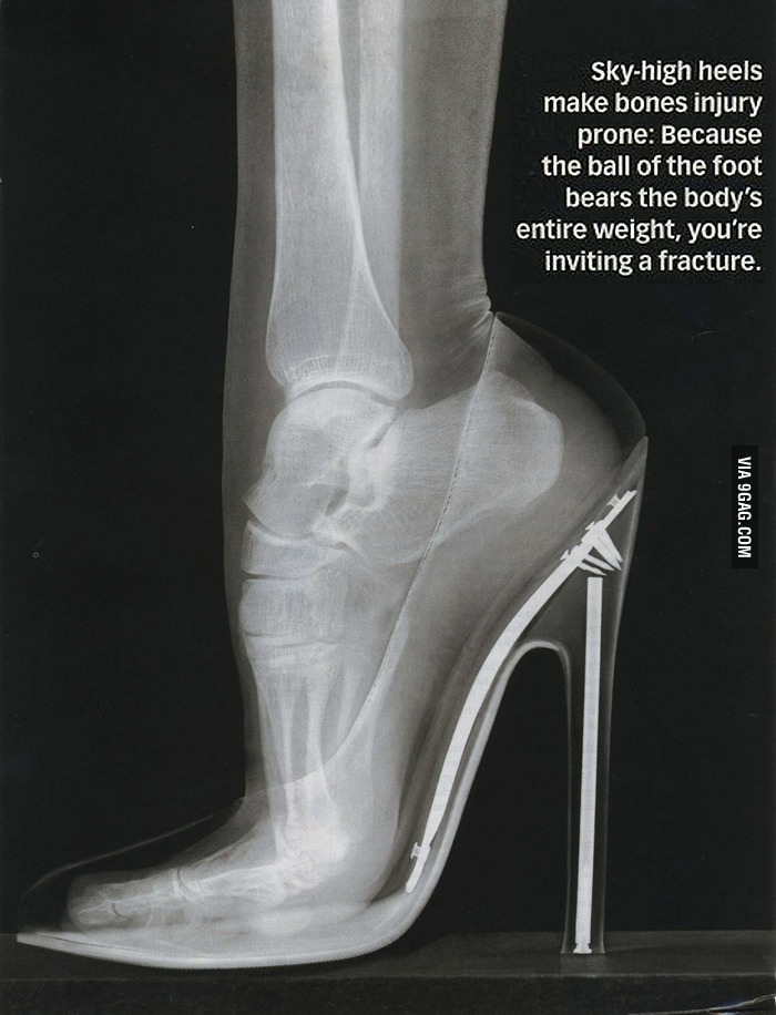 Think Chinese foot binding was 'weird'?