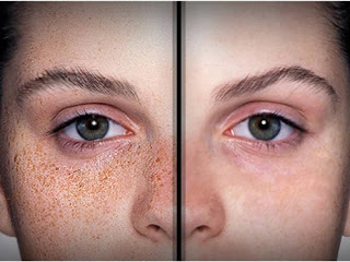 Como remover manchas fotos com photoshop online photoshop online