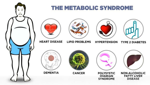 Metabolic Problems Related to Obesity and Diabetes