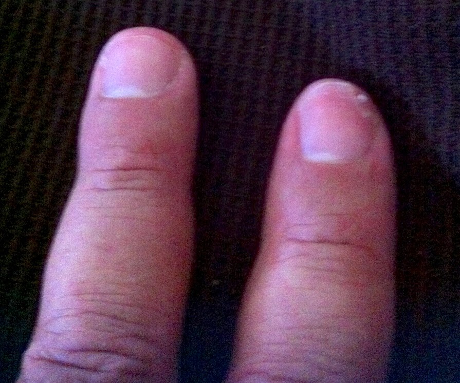 Thrilled to Death Paul Pavao's Leukemia Blog Day a Lot