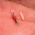 300 mil pessoas já implantaram biochips em seus corpos